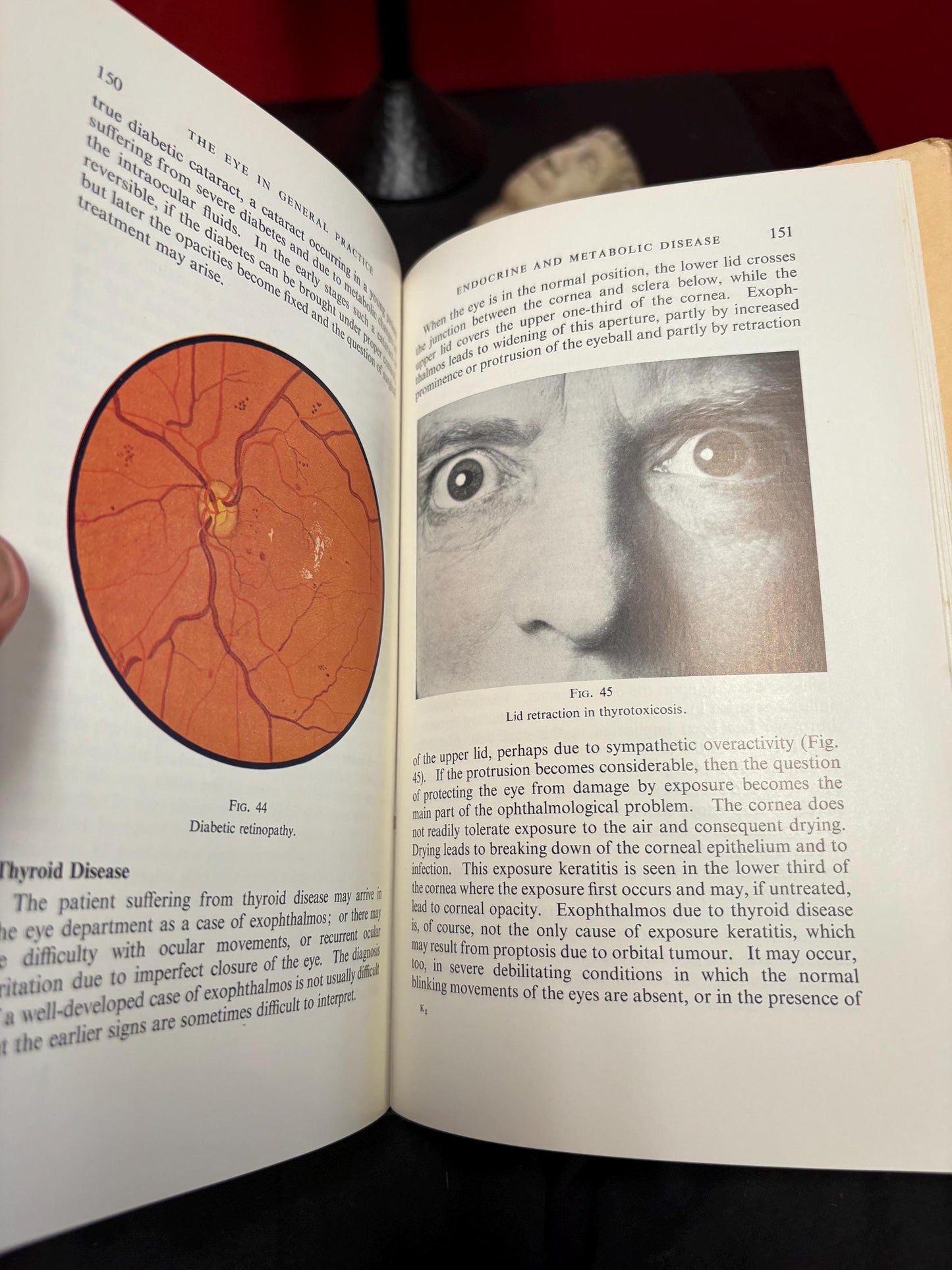 Interesting book entitled the Eye in general practice by C.R.S.Jackson  good condition fourth edition, 1967 - great gift